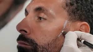 Rio Ferdinand reveals hair and beard transplant
