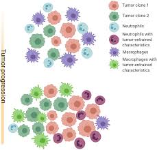 Lim & tan securities was established in 1973. Frontiers Tumor Associated Neutrophils And Macrophages Heterogenous But Not Chaotic Immunology