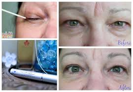 I continued using rapid lash and they eventually grew out, but not quite as long or thick as they were prior to falling out. Rapidlash Can Eyelashes And Eyebrows Be Rejuvenated