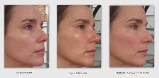Neutrogena Microdermabrasion Starter Kit At Home Skin Exfoliating And Firming Facial System Ne Microdermabrasion Facial System Microdermabrasion Treatment
