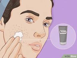 You're in for a treat 3 Easy Ways To Close Blackhead Holes Wikihow