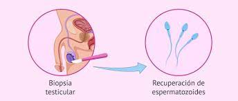 Como Saber Si Soy Esteril Pruebas De Fertilidad En El Hombre
