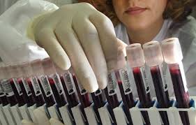 Victor velculescu at the johns hopkins kimmel cancer center investigated whether they could detect circulating dna from early tumors. The Us 500 Blood Test To Detect Early Signs Of Eight Cancer Types Using Algorithm That Detects Where Tumours Are South China Morning Post