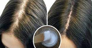 Infatti, è un ottimo rimedio per accelerare la crescita dei capelli. Come Eliminare La Forfora E Far Ricrescere I Capelli Con Il Bicarbonato Rimedio Naturale