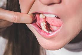 Image result for Tooth Extraction