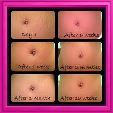 Bio Oil Before After Chaz Marie Hope On Instagram Well Look At This Stretch Marks Ladies These Results Oil For Stretch Marks Rodan And Fields Consultant Rodan And Fields