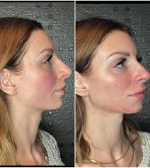 NW Beauty & Wellness‎