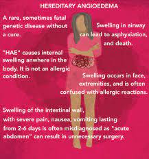 Pin On Hereditary Angioedema Hae