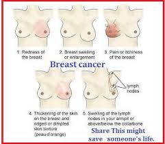 How long will it take me to recover after the surgery? Breasts Of Burden Www Thetracinator Com