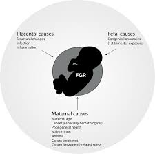 Cervical dysplasia and cancer of the cervix often have no symptoms. Management Of Pregnancy In Women With Cancer International Journal Of Gynecologic Cancer