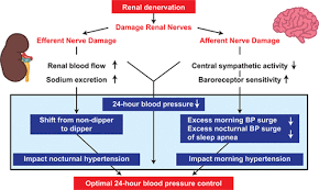 Check spelling or type a new query. Changes In 24 Hour Patterns Of Blood Pressure In Hypertension Following Renal Denervation Therapy Hypertension