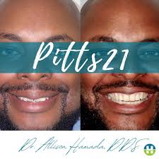 We all know that if we don't use it, we lose it, right? Because our foods  are becoming more and more processed with each generation, our jaws are  becoming smaller with each