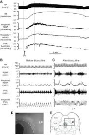 Example Of Response With Renal Sympathetic Nerve Activity