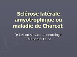 Ces dommages se situent principalement au niveau des les symptômes commencent habituellement dans vos pieds et vos jambes, mais ils peuvent éventuellement affecter vos mains et vos bras. Sclerose Laterale Amyotrophique Ou Maladie De Charcot Ppt Video Online Telecharger
