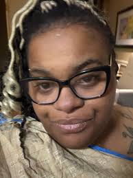 Just had mini bypass 07/15 doing well little pain