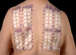 Image result for Patch Testing