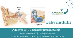 Image result for Acute Labyrinthitis