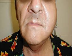 Parotid Gland Projects :: Photos, videos, logos, illustrations and branding  :: Behance