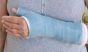 Kahnbeinbruch Behandlung Heilung Netdoktor At