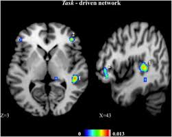 By gobra, last updated aug 24, 2020. Hearing Feelings A Quantitative Meta Analysis On The Neuroimaging Literature Of Emotional Prosody Perception Sciencedirect