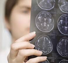 The frontal lobe is the area of your brain that controls your personality, so brain cancer could literally turn you into a. Q A Facts About Brain Tumors Henry Ford Livewell