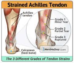 Maybe you would like to learn more about one of these? Tendinitis Information And Treatments