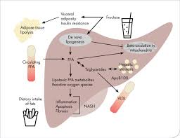 Schematic diagram of the histology of the liver. Figure This Diagram Illustrates Nonalcoholic Fatty Liver Disease Download Scientific Diagram