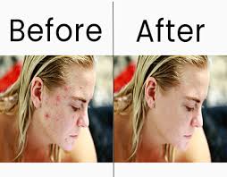 Spot Healing Photoshop Editing Projects :: Photos, videos, logos,  illustrations and branding :: Behance