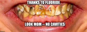 Image result for dental fluorosis