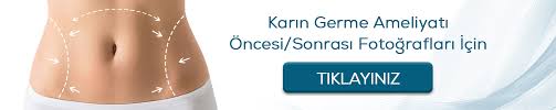 Karin Germe Ameliyati 2020 Fiyatlari Abdominoplasti Istanbul