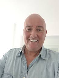 12 implants fitted in February in antalya, finished treatment in July. Best  thing I done