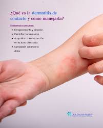 Image result for dermatitis contacta