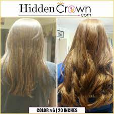 Hidden Crown Hair Extensions Before After Color 6 In 20 Inches Buy Yours At Www Hiddencrown Com Buy Human Hair Crown Hairstyles Human Hair Extensions