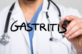 E' poi indispensabile evitare, specie nella fase acuta di gastrite, tutti gli alimenti ad alto tenore di grassi che potrebbero aumentare la secrezione di acido da parte dello stomaco quali: Cosa Mangiare Con La Gastrite Consigli Per Contrastarla