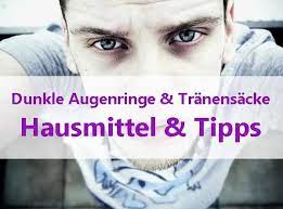 Dunkle Augenringe Tranensacke Hausmittel Und Tipps Vom Arzt