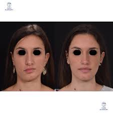 Face Surgery (@face_surgery_parma) • Instagram photos and videos