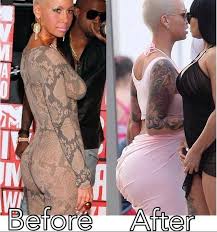 Pin On Fake Injected Ass