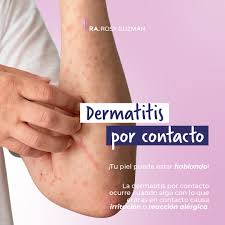 Image result for dermatitis contacta