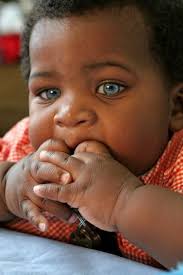 Black And Blue Eyes After Head Injury Half Black Blue Eyes Google Search Blue Eyed Baby People With Blue Eyes Black Hair Blue Eyes