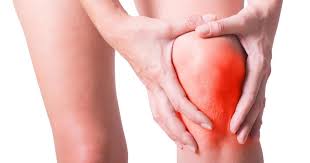 Image result for gout symptoms knee