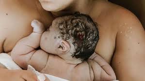 If your water breaks before 34 weeks, your doctor will probably give you antibiotics to fend off potential infections, plus. Amazing Video Shows Baby Born Inside Amniotic Sac Here S Why It Happens Motherly