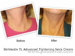 Strivectin Tl Advanced Tightening Neck Cream Giveaway Prime Beauty Blog Neck Cream Beauty Blog Beauty
