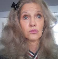 NHS advises varicose veins are swollen, twisted veins under the skin,  usually