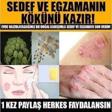 Dr Feridun Kunak Hocamizin Ozel Tarifiyle Hic Bir Yerde Bulamayacaginiz Ilk Defa Sitemizde Okuyacaginiz Sedef Ve Egzama Icin Health Psoriasis Skin Problems