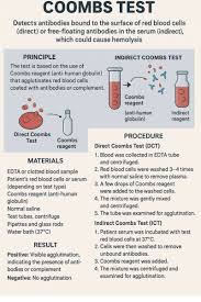 Image result for Indirect Coombs