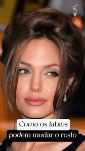 Um lábio definido, traz jovialidade e harmonia a face. Preenchimentos bem  planejados auxiliam muito no gerenciamento do envelhecimento, o segredo é  não exagerar😉