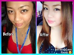 Black And White Bleaching Cream Side Effects Pin On Alternative Medicine