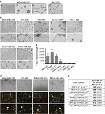 Yeap previously held the position of manager at texas instruments singapore (pte) ltd. Zeb1 Repressed Micrornas Inhibit Autocrine Signaling That Promotes Vascular Mimicry Of Breast Cancer Cells Oncogene