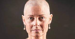 Don't stop using the prescription until your doctor says otherwise too. Breast Cancer Treatment And Hair Loss Prevention
