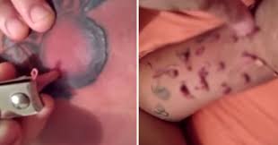 Here are signs to look for, including tips for when to head to the doctor. This Gnarly Tattoo Infection Is Like An Alien In This Guys Body Eww Video